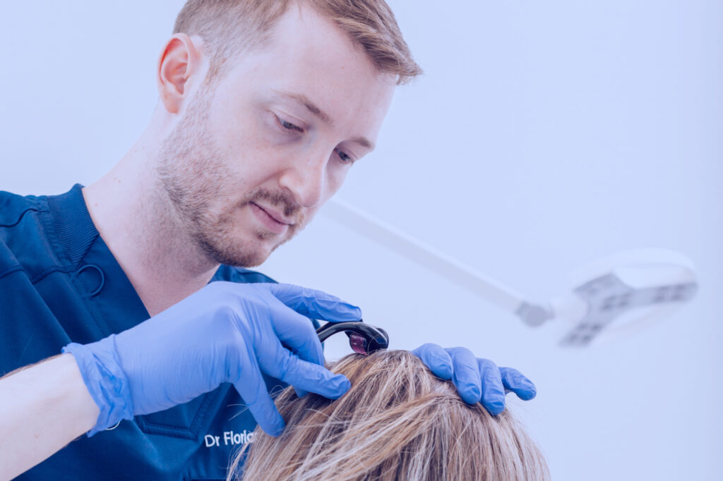 photo-slide-microneedling-mulhouse