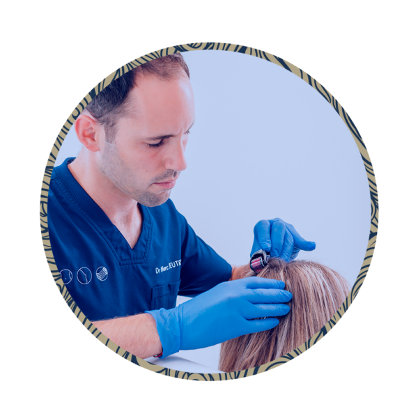 Microneedling